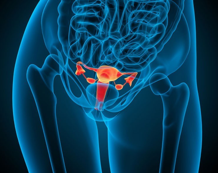 Fibroid Tumor Support